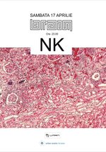 NK