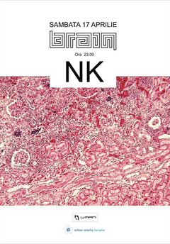 NK