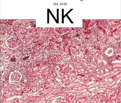 NK